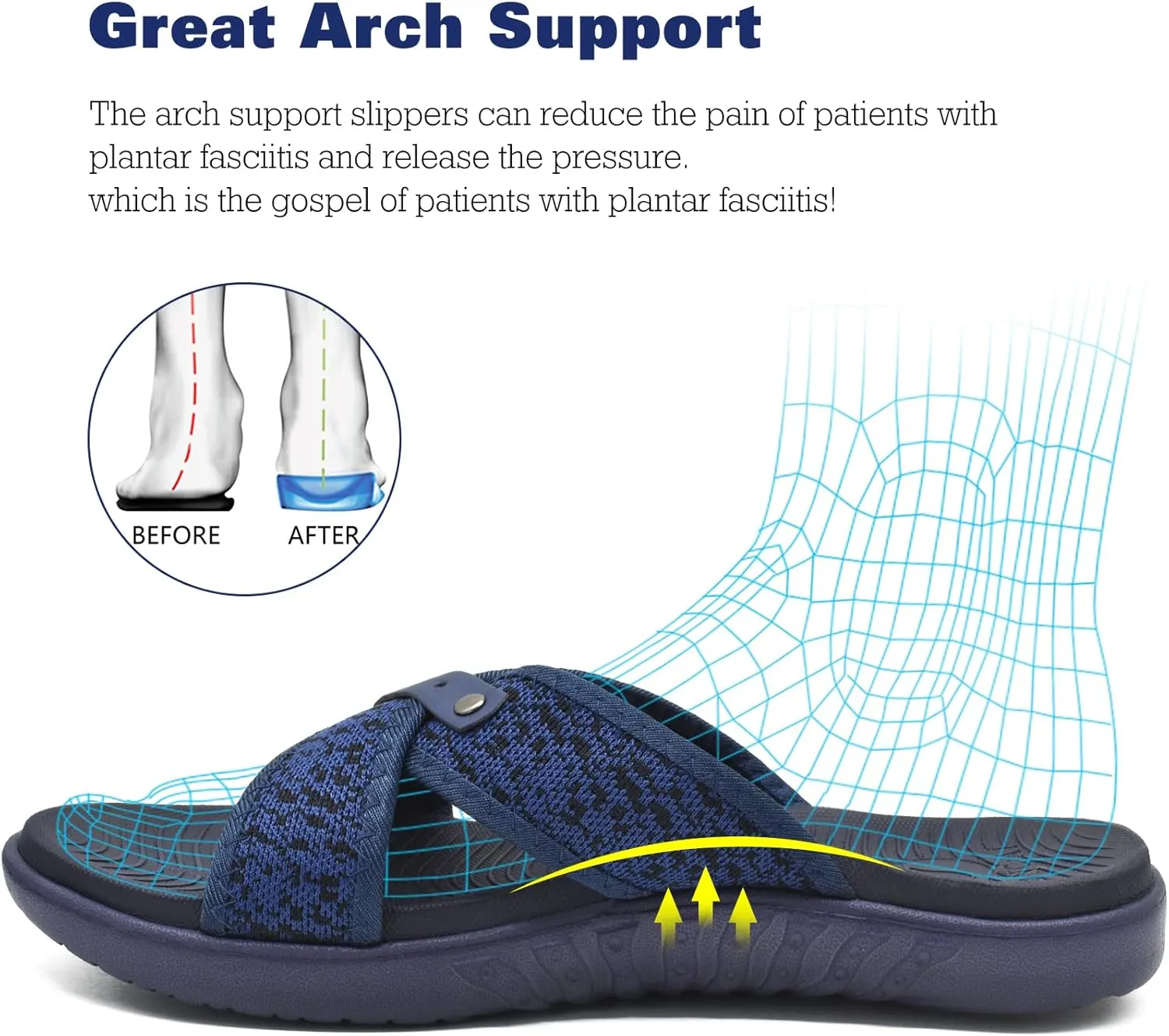 ONCAI Mens Criss Cross Sandals,Arch Support Recovery Sport Slippers Slides with Plantar Fasciitis Orthotic Footbed